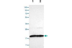 Image no. 4 for anti-Translocase of Outer Mitochondrial Membrane 22 Homolog (TOMM22) antibody (ABIN5589922)