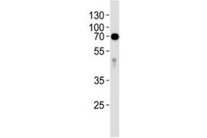 Image no. 4 for anti-Alkaline Phosphatase (ALP) (AA 274-304) antibody (ABIN3029903)