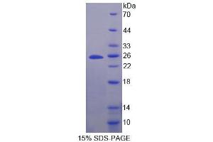 Image no. 1 for Secretogranin V (7B2 Protein) (SCG5) (AA 27-212) protein (His tag) (ABIN6236920)