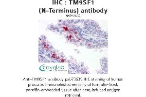Image no. 2 for anti-Transmembrane 9 Superfamily Member 1 (TM9SF1) (N-Term) antibody (ABIN1740139)