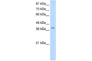 Image no. 1 for anti-K(lysine) Acetyltransferase 6B (KAT6B) (N-Term) antibody (ABIN2780878)