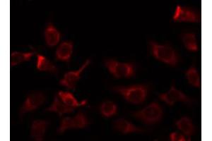 anti-Mitochondrial Ribosomal Protein L9 (MRPL9) (C-Term) antibody