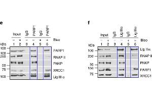 Image no. 16 for anti-Poly (ADP-Ribose) Polymerase 1 (PARP1) (Center) antibody (ABIN2854798)