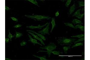 Immunofluorescence of monoclonal antibody to MCFD2 on HeLa cell.