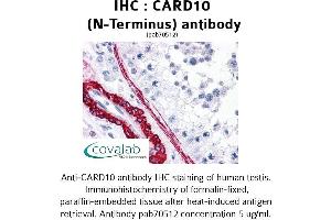 Image no. 2 for anti-Caspase Recruitment Domain Family, Member 10 (CARD10) antibody (ABIN1732633)