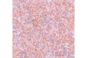 Image no. 3 for anti-Retinoblastoma Binding Protein 8 (RBBP8) (Internal Region) antibody (ABIN6656162)