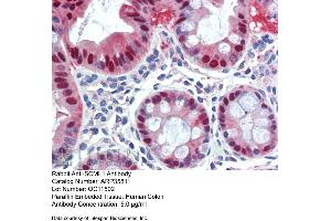 Image no. 1 for anti-Sex Comb On Midleg-Like 1 (SCML1) (Middle Region) antibody (ABIN2776468)