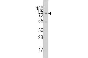 Image no. 1 for anti-K(lysine) Acetyltransferase 2A (KAT2A) (AA 65-94) antibody (ABIN3028777)