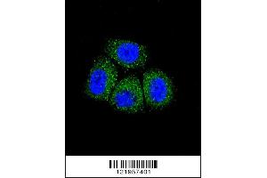 Image no. 3 for anti-Sodium Channel, Nonvoltage-Gated 1 alpha (SCNN1A) (AA 365-391) antibody (ABIN652752)