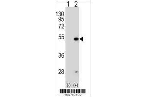 Image no. 1 for anti-Farnesyl-Diphosphate Farnesyltransferase 1 (FDFT1) (AA 1-30), (N-Term) antibody (ABIN389051)