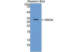 Image no. 1 for anti-Interleukin 17 Receptor D (IL17RD) (AA 356-603) antibody (ABIN1859364)