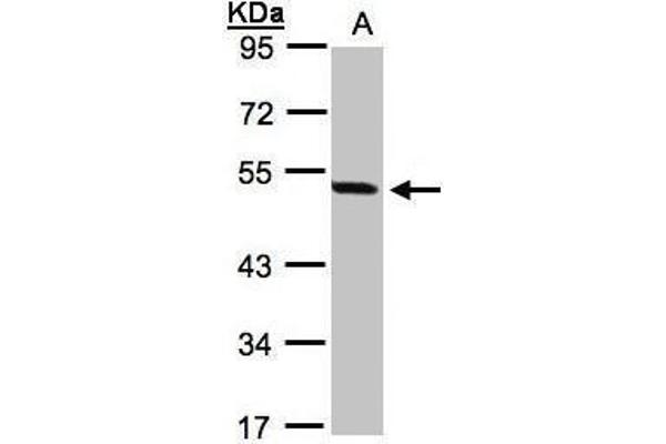 anti-Paired Box 8 (PAX8) (Center) antibody