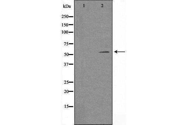 anti-tRNA Splicing Endonuclease 54 (TSEN54) (Internal Region) antibody
