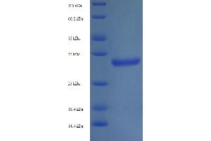 Image no. 1 for Trimethylguanosine Synthase 1 (TGS1) (AA 713-853), (partial) protein (His-SUMO Tag) (ABIN5711660)
