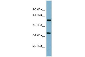 Image no. 1 for anti-Transmembrane Protein 158 (TMEM158) (Middle Region) antibody (ABIN2782853)
