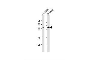 Image no. 7 for anti-Transforming Growth Factor, beta Receptor II (70/80kDa) (TGFBR2) (AA 13-40), (N-Term) antibody (ABIN655799)