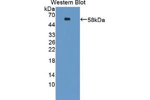 Image no. 1 for anti-Activin Receptor Type 1C (ACVR1C) (AA 21-493) antibody (ABIN5013073)