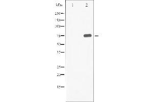 Image no. 2 for anti-Synapsin I (SYN1) (pSer9) antibody (ABIN6255558)