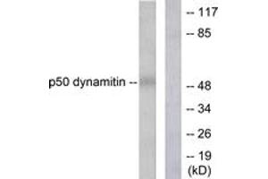 Image no. 1 for anti-Dynactin 2 (p50) (DCTN2) (AA 341-390) antibody (ABIN1533369)
