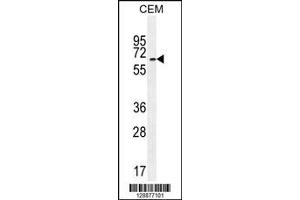 Image no. 1 for anti-UNC Homeobox (UNCX) (AA 382-410), (C-Term) antibody (ABIN655115)