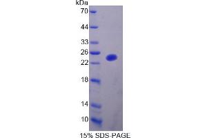 Image no. 1 for Sex Hormone Binding Globulin (SHBG) (AA 44-222) protein (His tag) (ABIN6238170)