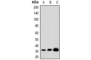 Image no. 1 for anti-Kruppel-Like Factor 13 (KLF13) (acLys166) antibody (ABIN3222923)