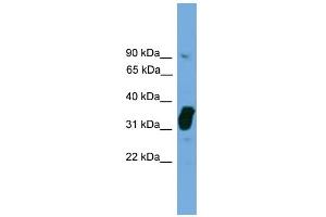 anti-Nitric Oxide Synthase Interacting Protein (NOSIP) (Middle Region) antibody