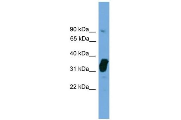 anti-Nitric Oxide Synthase Interacting Protein (NOSIP) (Middle Region) antibody