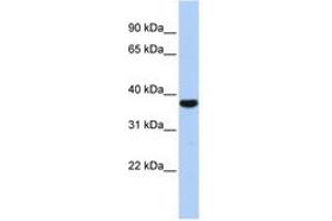 Image no. 1 for anti-Exosome Component 2 (EXOSC2) (AA 143-192) antibody (ABIN6740694)