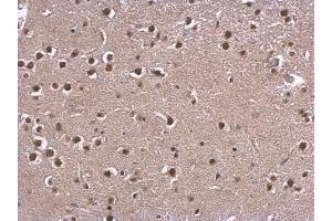IHC-P Image CBP antibody [C3], C-term detects CBP protein at nucleus on mouse fore brain by immunohistochemical analysis.