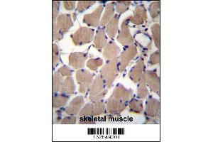 Image no. 1 for anti-phosphofurin Acidic Cluster Sorting Protein 2 (PACS2) (AA 642-671), (C-Term) antibody (ABIN657066)