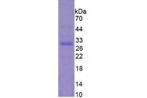 Image no. 1 for Cardiac Troponin I (TNNI3) protein (ABIN3012038)