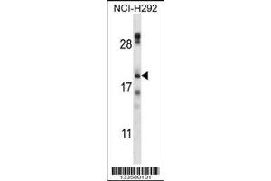 Image no. 1 for anti-Transmembrane Protein 17 (TMEM17) (AA 6-35), (N-Term) antibody (ABIN657609)