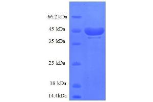 RPS14 Protein (Ribosomal Protein S14) (AA 2-146, partial) (GST tag)