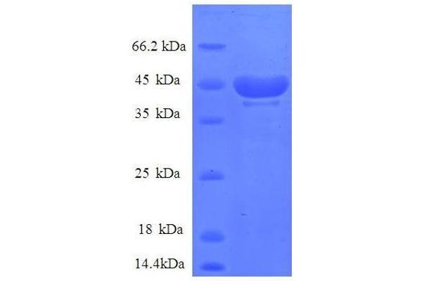 RPS14 Protein (Ribosomal Protein S14) (AA 2-146, partial) (GST tag)
