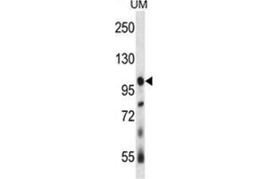 Image no. 1 for anti-Ubiquitin Specific Peptidase 4 (USP4) (AA 1-30), (N-Term) antibody (ABIN955490)