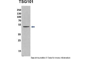 Image no. 2 for anti-Tumor Susceptibility Gene 101 (TSG101) (Middle Region) antibody (ABIN2780037)