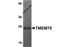 Image no. 2 for anti-Transmembrane Protein 70 (TMM70) (Middle Region) antibody (ABIN1031136)