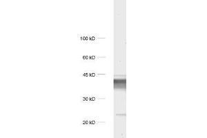 Image no. 1 for anti-Synaptoporin (SYNPR) antibody (ABIN2850852)