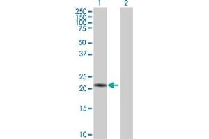 Image no. 2 for anti-Proteasome Subunit beta 3 (PSMB3) (AA 1-205) antibody (ABIN519373)