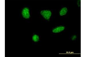 Image no. 2 for anti-Microspherule Protein 1 (MCRS1) (AA 1-462) antibody (ABIN523843)