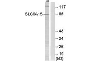 Image no. 1 for anti-Solute Carrier Family 6 (Neutral Amino Acid Transporter), Member 15 (SLC6A15) (AA 32-81) antibody (ABIN1535138)