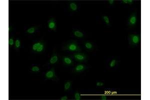 Image no. 6 for anti-Polo-Like Kinase 1 (PLK1) (AA 1-603) antibody (ABIN562277)