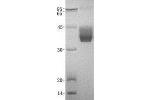 Image no. 1 for Kallikrein 1 (KLK1) protein (ABIN2724312)