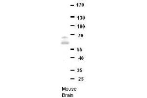 Image no. 3 for anti-Downstream Neighbor of SON (DONSON) (Middle Region) antibody (ABIN2782388)