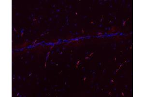 Image no. 3 for anti-Malignant T Cell Amplified Sequence 1 (MCTS1) antibody (ABIN4889917)