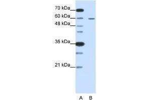 Image no. 1 for anti-Frizzled Family Receptor 5 (FZD5) (C-Term) antibody (ABIN2776706)
