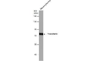 Image no. 2 for anti-Transferrin (TF) (Center) antibody (ABIN2854907)