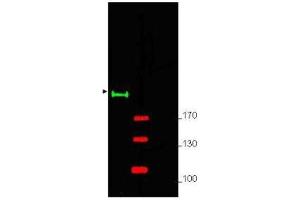 Western blot using  Affinity Purified anti-Gli-2 antibody shows detection of a predominant band at ~190 kDa corresponding to Gli-2 (arrowhead) in mouse brain whole cell lysate (lane 1).