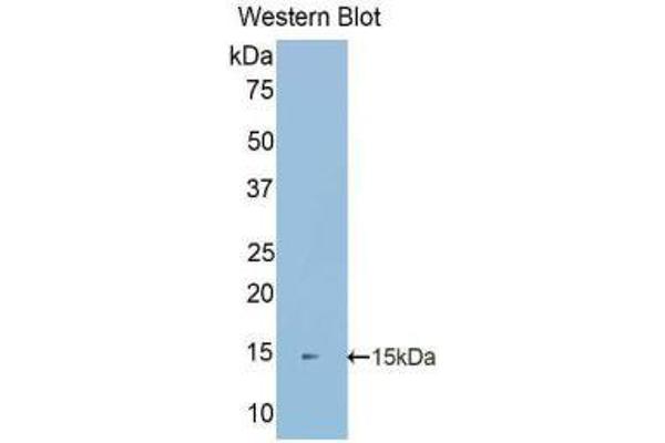 anti-S100 Calcium Binding Protein A16 (S100A16) (AA 2-103) antibody